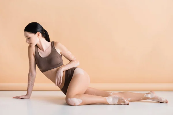 Jovem mulher bonita com vitiligo posando no chão sobre fundo bege — Fotografia de Stock