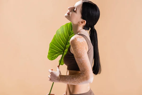 Vista lateral de sorrir jovem bela mulher com vitiligo posando com folha verde isolada no bege — Fotografia de Stock