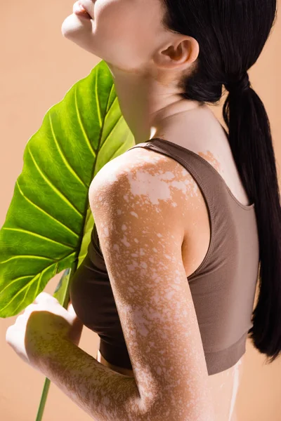 Частичный вид молодой красивой женщины с витилиго позирует с зеленым листом изолированы на бежевый — стоковое фото