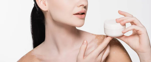 Vista cortada de jovem mulher bonita com vitiligo segurando creme cosmético isolado no branco, banner — Fotografia de Stock