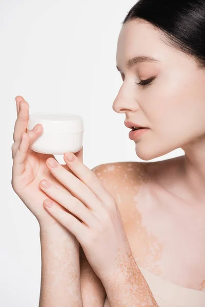 Junge schöne Frau mit Vitiligo hält kosmetische Creme isoliert auf weiß — Stockfoto