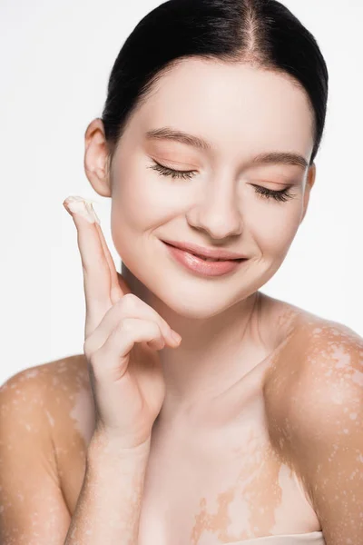 Lächelnde junge schöne Frau mit Vitiligo Anwendung kosmetischer Creme isoliert auf weiß — Stockfoto