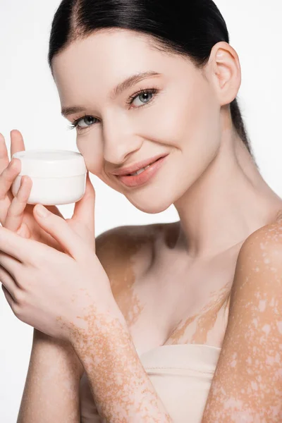 Sorrindo jovem bela mulher com vitiligo segurando creme cosmético isolado no branco — Fotografia de Stock