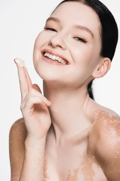 Sonriente joven hermosa mujer con vitiligo aplicación de crema cosmética aislado en blanco - foto de stock