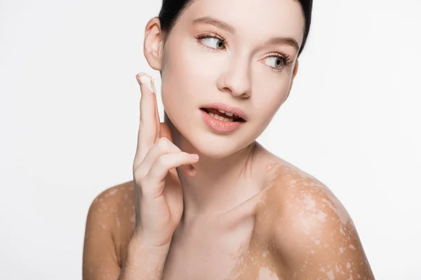 Young beautiful woman with vitiligo applying cosmetic cream isolated on white — Stock Photo