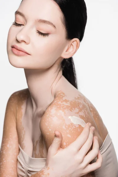 Young beautiful woman with vitiligo applying cosmetic cream on shoulder isolated on white — Stock Photo