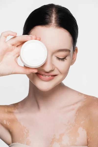 Smiling young beautiful woman with vitiligo holding cosmetic cream isolated on white — Stock Photo