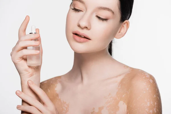 Young beautiful woman with vitiligo holding serum isolated on white — Stock Photo