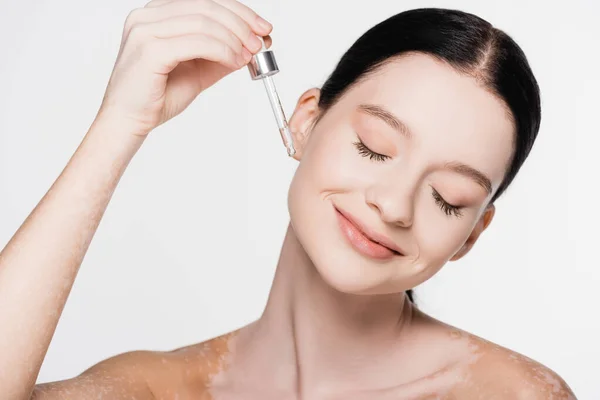 Lächelnde junge schöne Frau mit Vitiligo Anwendung Serum isoliert auf weiß — Stockfoto