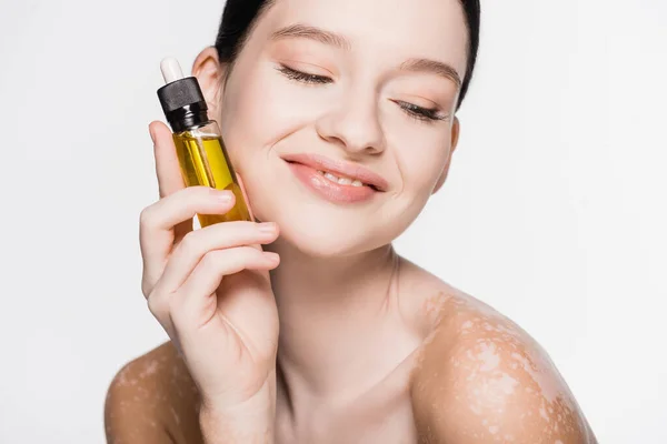 Lächelnde junge schöne Frau mit Vitiligo hält ätherisches Öl isoliert auf weiß — Stockfoto