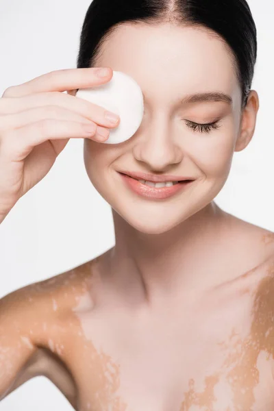 Souriant jeune belle femme avec vitiligo visage nettoyant avec tampon de coton isolé sur blanc — Photo de stock