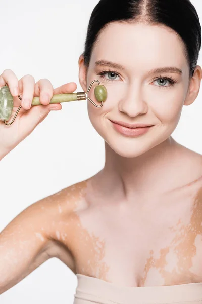 Smiling young beautiful woman with vitiligo using jade roller on face isolated on white — Stock Photo