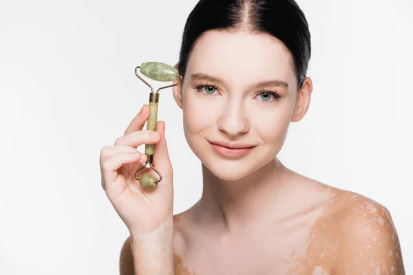 Smiling young beautiful woman with vitiligo holding jade roller on face isolated on white — Stock Photo