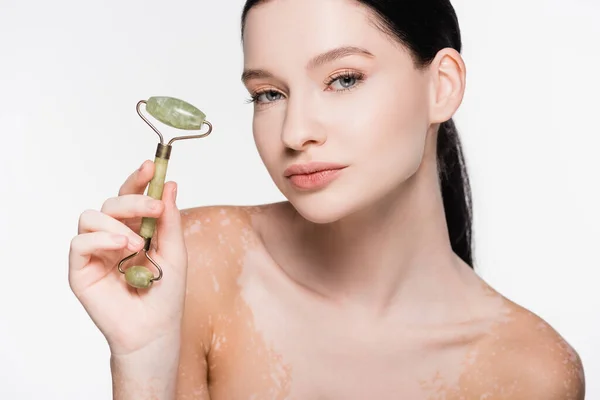 Young beautiful woman with vitiligo holding jade roller on face isolated on white — Stock Photo