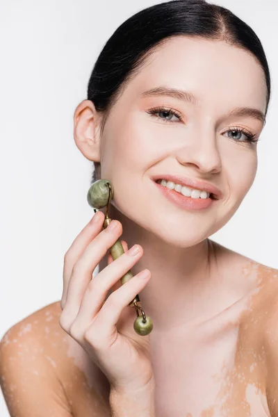 Sorrindo jovem bela mulher com vitiligo usando jade rolo no rosto isolado no branco — Fotografia de Stock