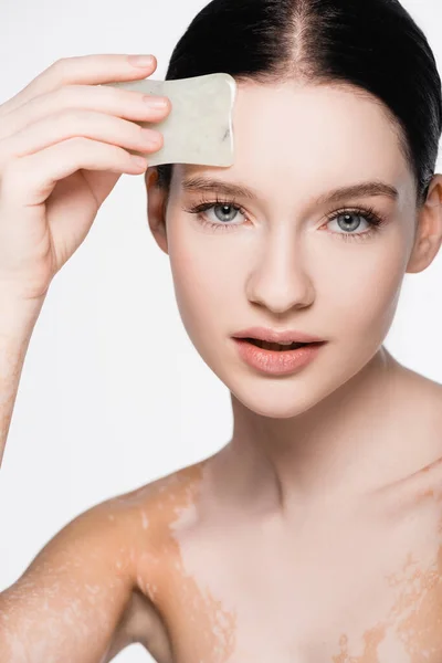 Young beautiful woman with vitiligo using gua sha isolated on white — Stock Photo