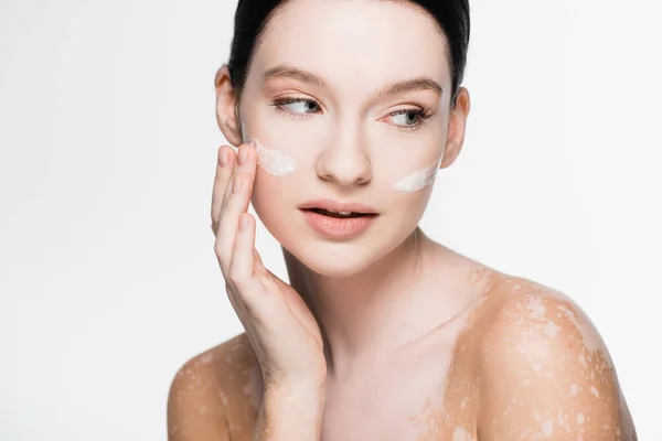 Joven hermosa mujer con vitiligo y crema facial en las mejillas aisladas en blanco - foto de stock