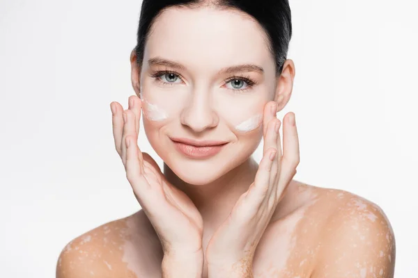 Lächelnde junge schöne Frau mit Vitiligo und Gesichtscreme auf den Wangen isoliert auf weiß — Stockfoto