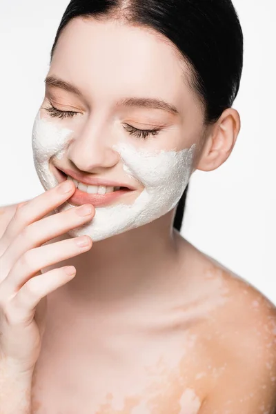 Smiling young beautiful woman with vitiligo and clay mask on face isolated on white — Stock Photo