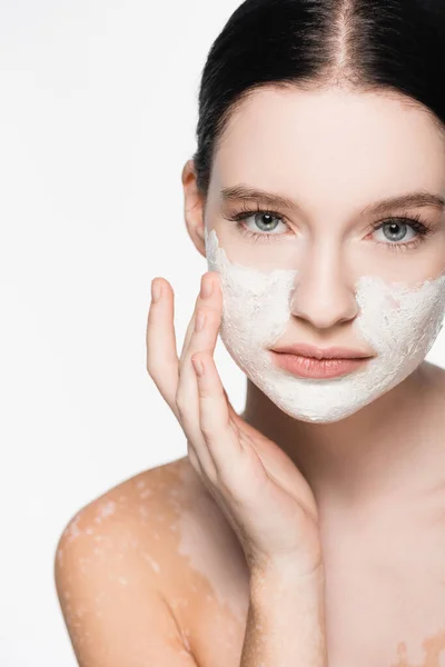 Young beautiful woman with vitiligo and clay mask on face isolated on white — Stock Photo