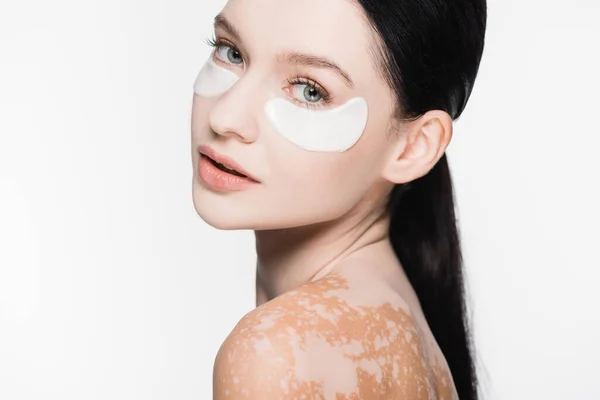 Young beautiful woman with vitiligo and eye patches on face isolated on white — Stock Photo
