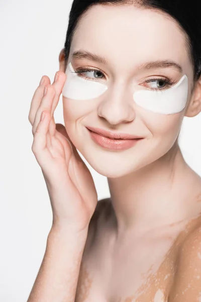 Smiling young beautiful woman with vitiligo and eye patches on face isolated on white — Stock Photo