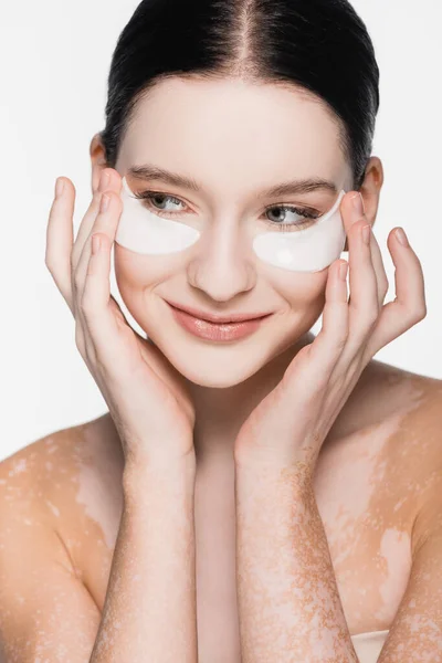 Souriant jeune belle femme avec vitiligo et patchs sur le visage isolé sur blanc — Photo de stock