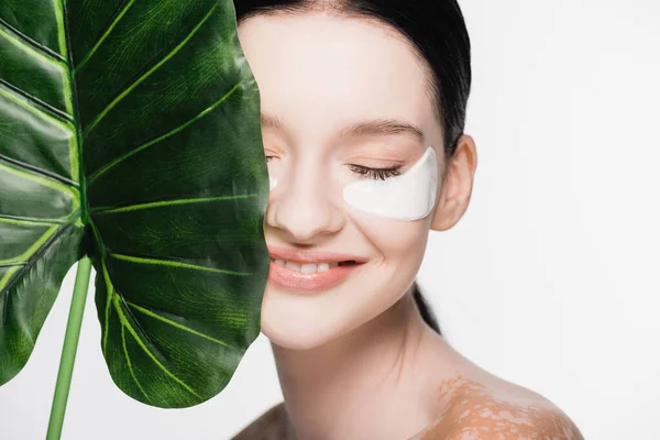 Sonriente joven hermosa mujer con vitiligo y parches en los ojos en la cara cerca de hoja verde aislado en blanco - foto de stock