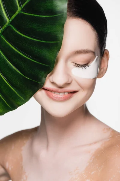 Sonriente joven hermosa mujer con vitiligo y parches en los ojos en la cara cerca de hoja verde aislado en blanco - foto de stock