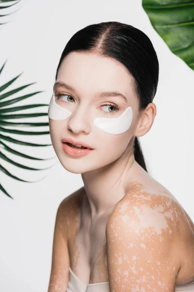 Young beautiful woman with vitiligo and eye patches on face isolated on white — Stock Photo