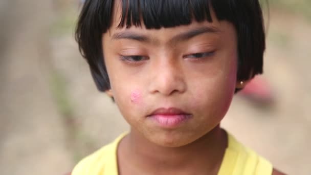 Jong Lankan meisje met down syndroom in Ella — Stockvideo