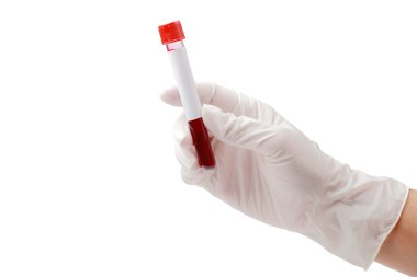 Tüp kan plazması ile wh üzerinde sınama için hazır tutan el