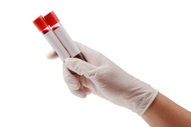 Tüp kan plazması ile Isola sınama için hazır tutan el
