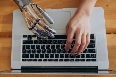 Kadın dizüstü bilgisayarda klavye yazmak için metal biyonik kol kullanıyor.
