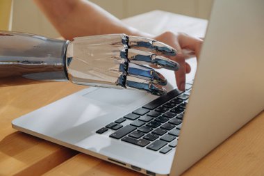 Kadın dizüstü bilgisayarda klavye yazmak için metal biyonik kol kullanıyor.