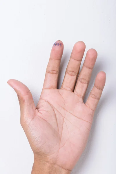 人差し指を傷します。 — ストック写真