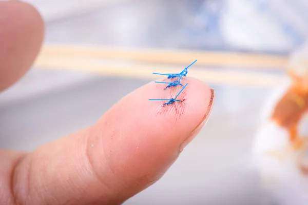 Wound on forefinger — Stock Photo, Image