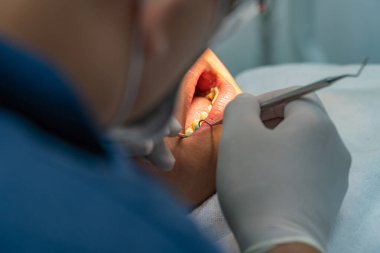 İstemci için kontrol yaparken diş pulu kullanan ortodontist 