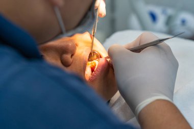 Diş hekimi diş kontrolü yaparken diş araştırması ve ölçeklendirici kullanıyor