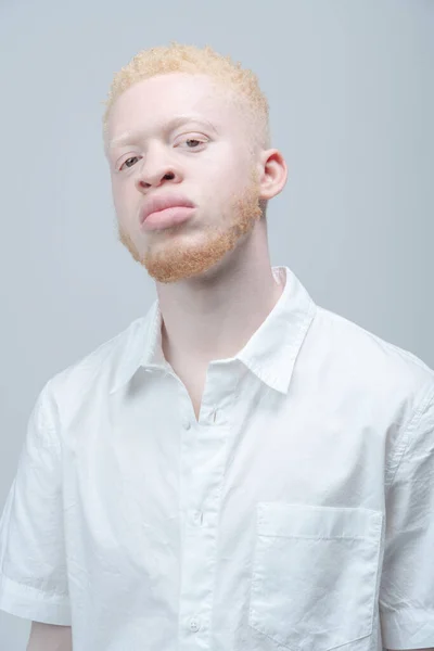 Studio Portrait Albino Man White Shirt — Stock Photo, Image