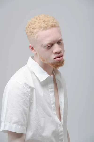 Estúdio Retrato Albino Homem Camisa Branca — Fotografia de Stock