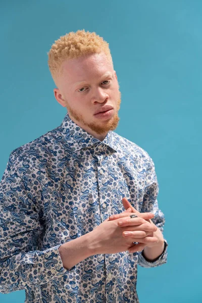Studioporträt Eines Albino Mannes Blau Gemusterten Hemd — Stockfoto