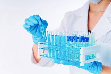 Kimya laboratuvarı. Uyuşturucunun bileşiminin kontrolü. Yeni aşıların geliştirilmesi. Laboratuvar önü cam ve deney tüpleriyle dolu şişeyi tutan bilim adamının elleri kimya laboratuarı arka planı, bilim laboratuarı araştırma ve geliştirme kavramı..