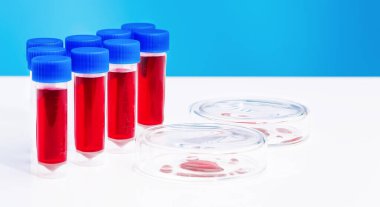 Laboratuvardaki test tüpleri kapanıyor. Kan örnekleri, kan testi, kan enfeksiyonu testi. Yeni cihazların araştırması. İlaç laboratuarı..