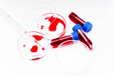 Laboratuvardaki test tüpleri kapanıyor. Kan örnekleri, kan testi, kan enfeksiyonu testi. Yeni cihazların araştırması. İlaç laboratuarı..