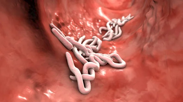 Ronde Wormen Menselijke Darm Computer Illustratie Rondwormen Nematoden Omvatten Tal — Stockfoto
