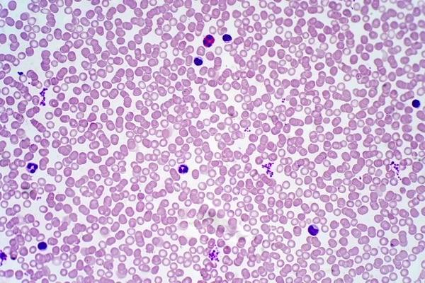 Emberi Vérsejtek Fénymikrográf — Stock Fotó