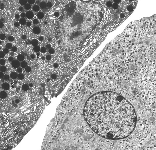 Buňky Slinivky Barevný Transmisní Elektronový Mikrograf Tem Acinárních Exokrinních Pankreatických — Stock fotografie