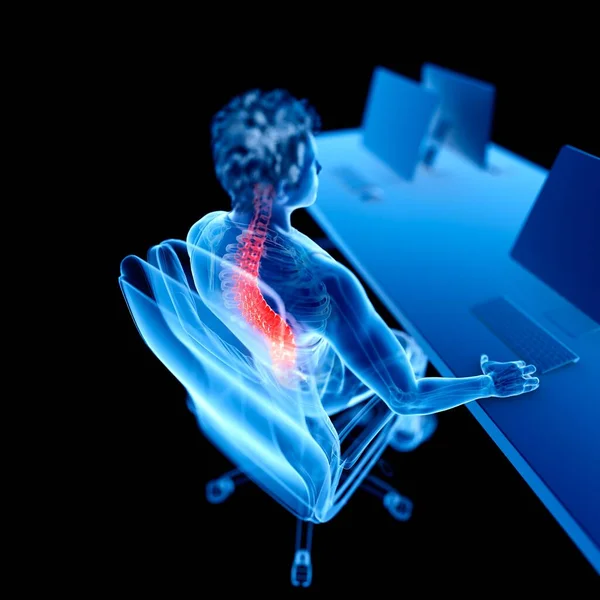 Office Worker Back Pain Computer Illustration — Stock Photo, Image