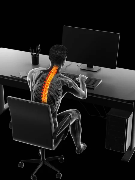 Hombre Con Dolor Espalda Debido Sentarse Ilustración Computadora —  Fotos de Stock
